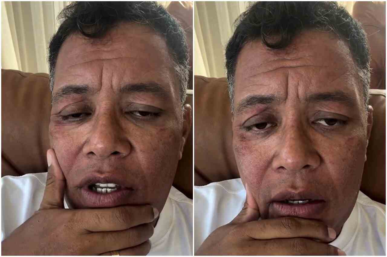 Anderson Freire enfrenta alergia grave e expõe descaso em hospital particular